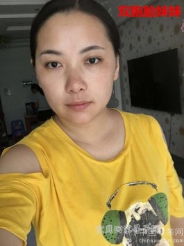 失踪人员：寻1990年6月初8生，高坪区李渡镇新场乡雷家沟黄果树下的双胞胎姐姐